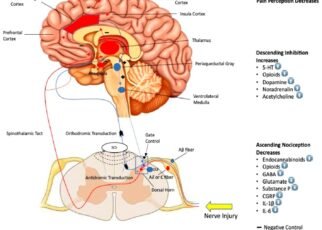 Understanding Neuromodulation: A Modern Solution for Chronic Pain Relief