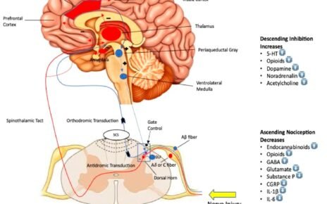 Understanding Neuromodulation: A Modern Solution for Chronic Pain Relief